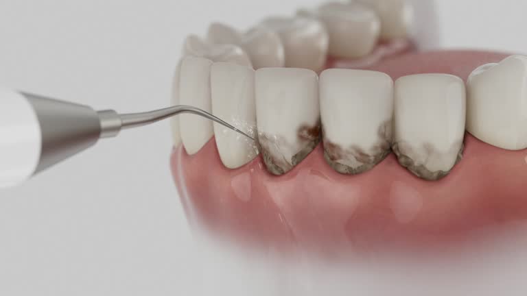 Trusted Wisdom Tooth Removal service in Neuse Forest, NC - Dentist Open Now